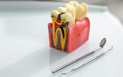 How Long Does It Take to Fill a Cavity?